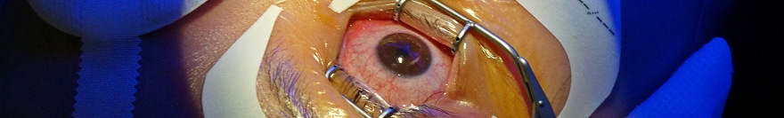 Augenlasern bei Alterssichtigkeit mit Presbyond